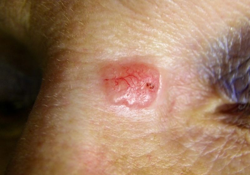 Apresentação clínica